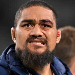 Le dernier remplaçant des All Blacks retiré du match contre les Lions pour cause de maladie